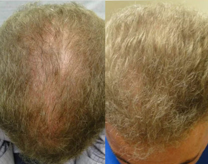 Lustrao Hair regrowth oil